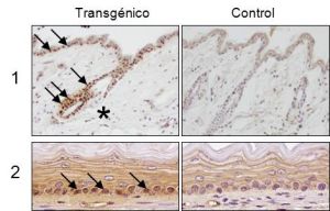 image of the Transposons topic