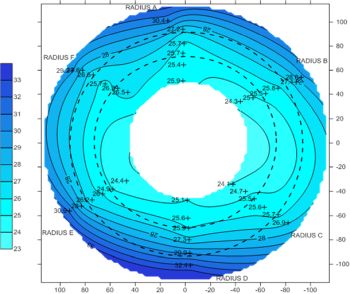 Fig. 7. Contour plots for the bentonite barrier water content after 18 years operation around the heater (left) and in an area outside the heater influence (right). 
