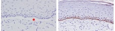 Un producto que combina edición genómica y bioingeniería tisular, designado medicamento huérfano para la piel de mariposa