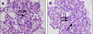 CIEMAT / CIBERONC scientists authors of a work published in the journal Cancers